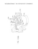 Method and Apparatus for Computerized Surgery diagram and image