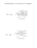 Method and Apparatus for Computerized Surgery diagram and image