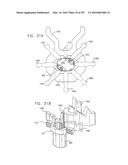 Method and Apparatus for Computerized Surgery diagram and image