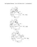 Method and Apparatus for Computerized Surgery diagram and image