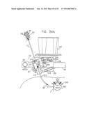 Method and Apparatus for Computerized Surgery diagram and image