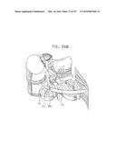 Method and Apparatus for Computerized Surgery diagram and image