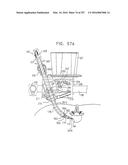 Method and Apparatus for Computerized Surgery diagram and image