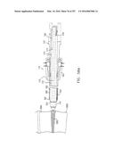 Method and Apparatus for Computerized Surgery diagram and image