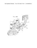 Method and Apparatus for Computerized Surgery diagram and image