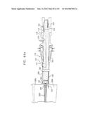 Method and Apparatus for Computerized Surgery diagram and image