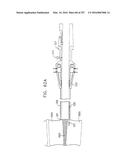 Method and Apparatus for Computerized Surgery diagram and image