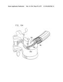 Method and Apparatus for Computerized Surgery diagram and image