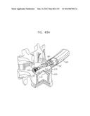 Method and Apparatus for Computerized Surgery diagram and image