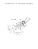 Method and Apparatus for Computerized Surgery diagram and image