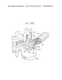 Method and Apparatus for Computerized Surgery diagram and image