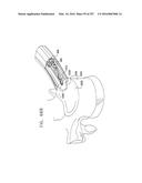 Method and Apparatus for Computerized Surgery diagram and image