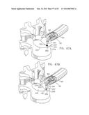 Method and Apparatus for Computerized Surgery diagram and image