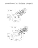 Method and Apparatus for Computerized Surgery diagram and image