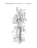 FEMORAL COMPONENT INSTRUMENT diagram and image