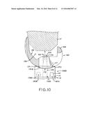 FEMORAL COMPONENT INSTRUMENT diagram and image