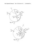 DEVICES, SYSTEMS AND METHODS FOR POSTERIOR SEGMENT DRAINAGE diagram and image