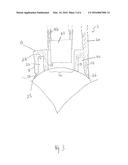 TREPHINE GUIDE diagram and image