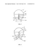 Shock Wave Electrodes with Fluid Holes diagram and image