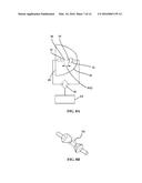 Shock Wave Electrodes with Fluid Holes diagram and image