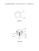 Shock Wave Electrodes with Fluid Holes diagram and image