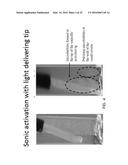 PHOTO-CHEMICALLY ACTIVATED MICRO-BUBBLE BASED ROOT CANAL DISINFECTION diagram and image