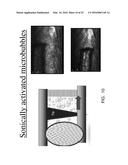 PHOTO-CHEMICALLY ACTIVATED MICRO-BUBBLE BASED ROOT CANAL DISINFECTION diagram and image