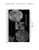 PHOTO-CHEMICALLY ACTIVATED MICRO-BUBBLE BASED ROOT CANAL DISINFECTION diagram and image