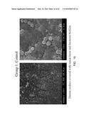 PHOTO-CHEMICALLY ACTIVATED MICRO-BUBBLE BASED ROOT CANAL DISINFECTION diagram and image