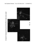 PHOTO-CHEMICALLY ACTIVATED MICRO-BUBBLE BASED ROOT CANAL DISINFECTION diagram and image