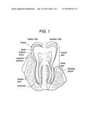 ORAL CARE COMPOSITIONS FOR TREATMENT OF SENSITIVE TEETH diagram and image