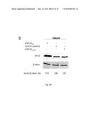 SERCA INHIBITOR AND CALMODULIN ANTAGONIST COMBINATION diagram and image