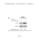 SERCA INHIBITOR AND CALMODULIN ANTAGONIST COMBINATION diagram and image