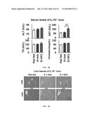 USE OF GINSENOSIDE F2 FOR PROPHYLAXIS AND TREATMENT OF LIVER DISEASE diagram and image