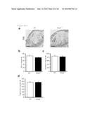 ANTAGONISM OF ABCG4, LYN KINASE, AND C-CBL E3 LIGASE TO INCREASE PLATELET     COUNT AS THERAPY FOR THROMBOCYTOPENIA diagram and image