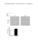 ANTAGONISM OF ABCG4, LYN KINASE, AND C-CBL E3 LIGASE TO INCREASE PLATELET     COUNT AS THERAPY FOR THROMBOCYTOPENIA diagram and image