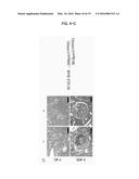 INHIBITOR OF EXTRACELLULAR TRAP FORMATION IN LEUKOCYTES diagram and image