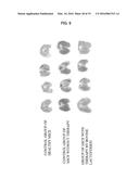 INHIBITOR OF EXTRACELLULAR TRAP FORMATION IN LEUKOCYTES diagram and image