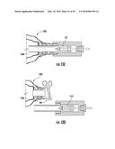 Devices, Systems, and Methods for Implanting and Using a Connector in a     Tissue Wall diagram and image