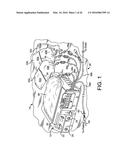 DRAIN AND FILL LOGIC FOR AUTOMATED PERITONEAL DIALYSIS diagram and image