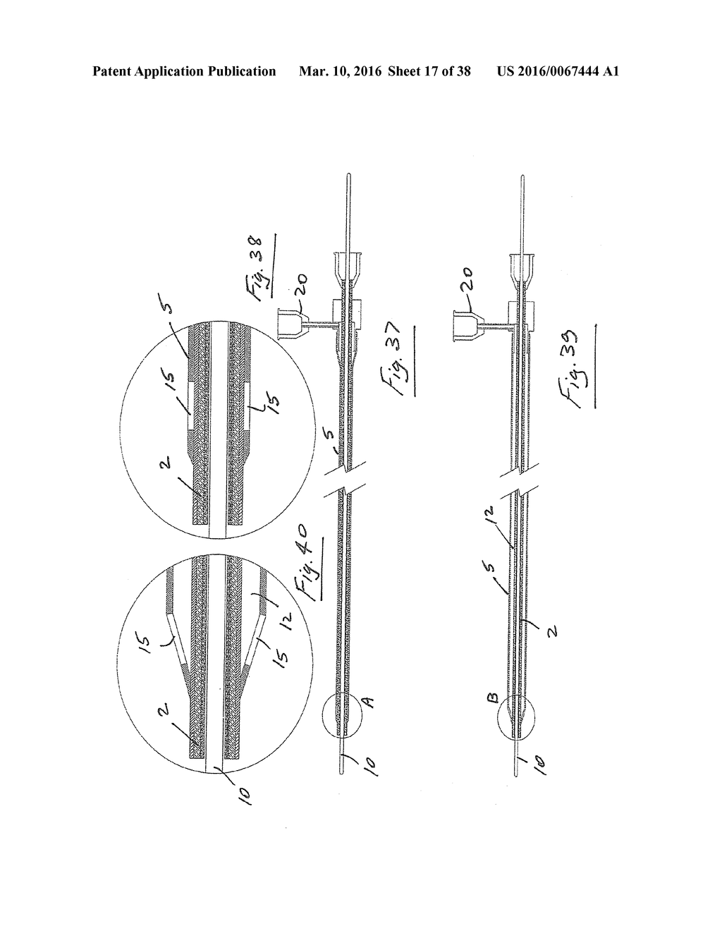 A Catheter Having an Expansile Sheath - diagram, schematic, and image 18