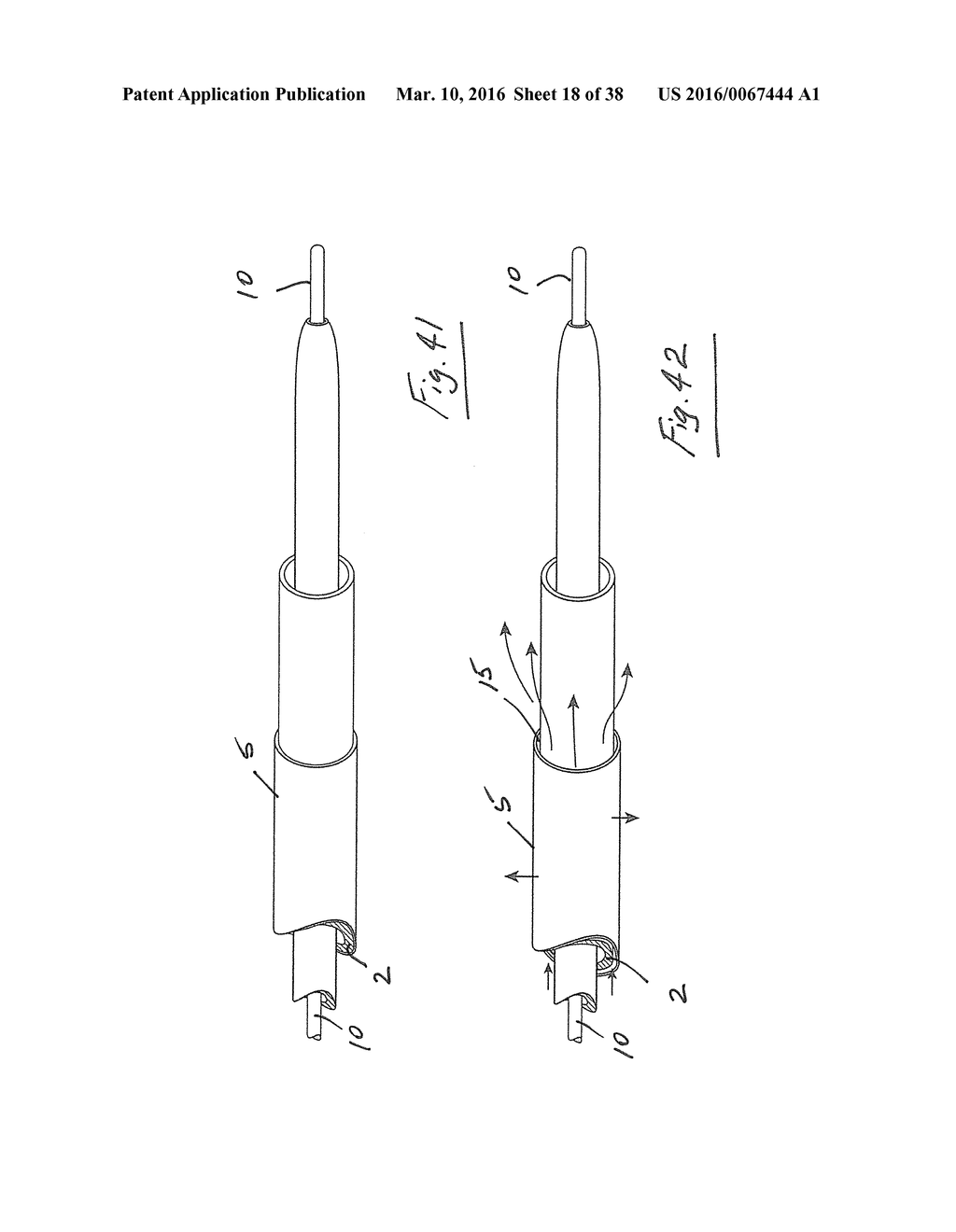 A Catheter Having an Expansile Sheath - diagram, schematic, and image 19