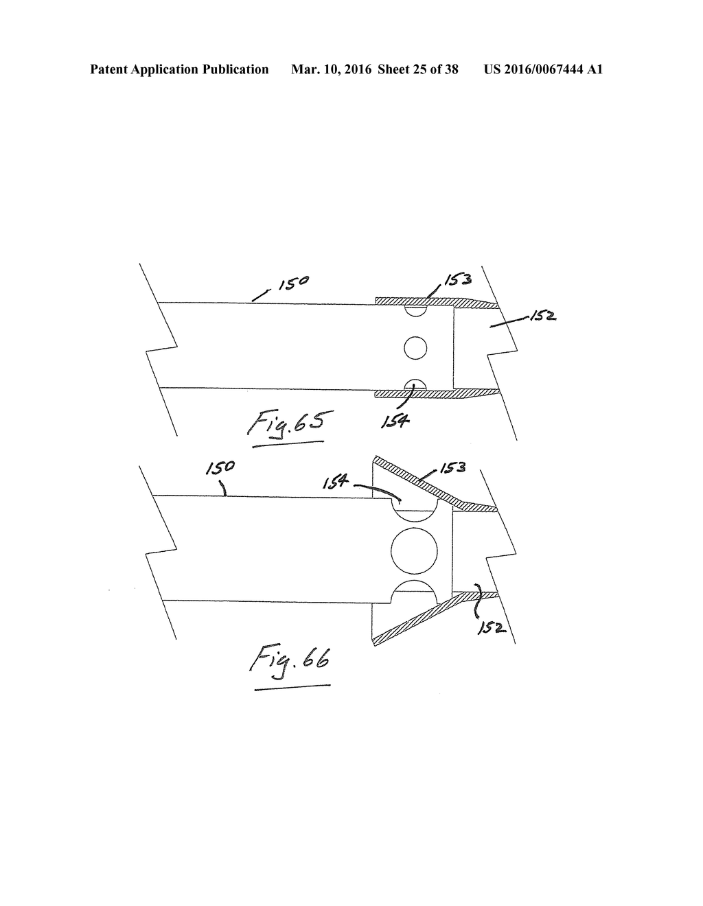 A Catheter Having an Expansile Sheath - diagram, schematic, and image 26