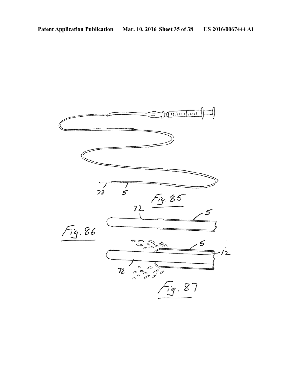 A Catheter Having an Expansile Sheath - diagram, schematic, and image 36