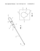CATHETER INSERTION DEVICE INCLUDING RETRACTABLE NEEDLE diagram and image