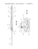 CATHETER INSERTION DEVICE INCLUDING RETRACTABLE NEEDLE diagram and image