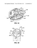 Methods and Devices for Locating and Adjusting an Implantable Valve diagram and image