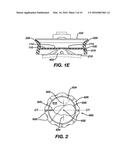 Methods and Devices for Locating and Adjusting an Implantable Valve diagram and image