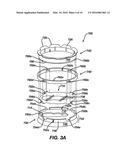 Methods and Devices for Locating and Adjusting an Implantable Valve diagram and image