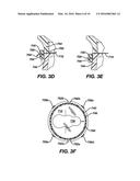 Methods and Devices for Locating and Adjusting an Implantable Valve diagram and image